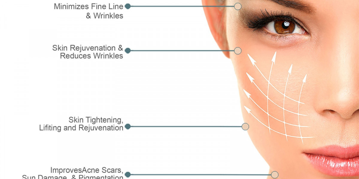 Article Picture