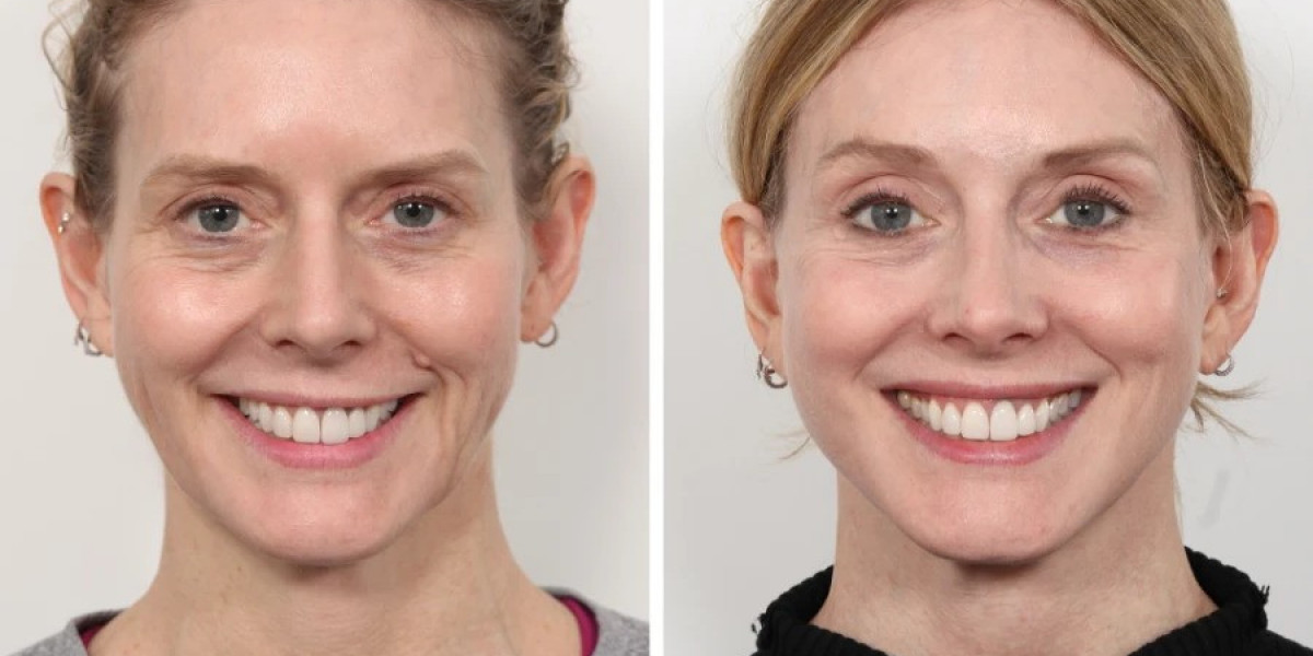Best Doctors in Dubai for Advanced Anti-Aging Solutions