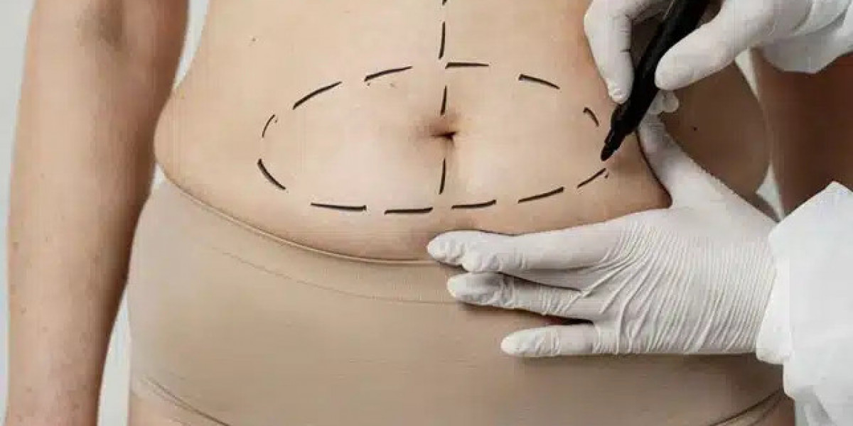 Essential Aftercare Tips Following a Tummy Tuck in Dubai