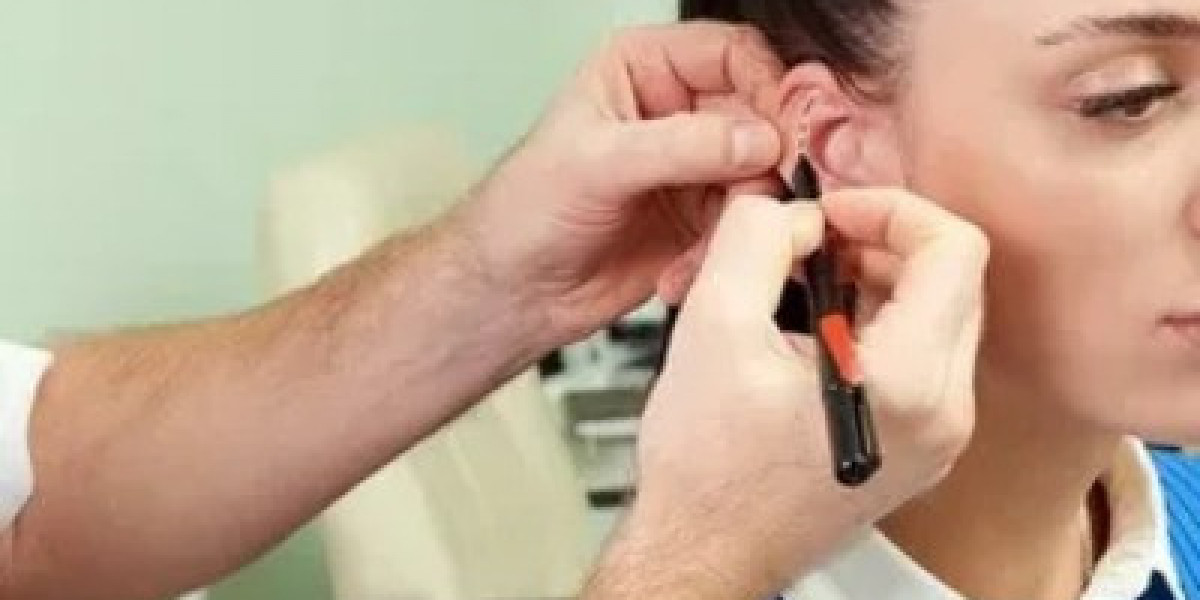 How Can Ear Reshaping Improve Ear Contour?