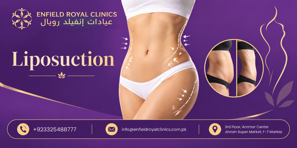 Is Liposuction Helpful for Localized Fat?
