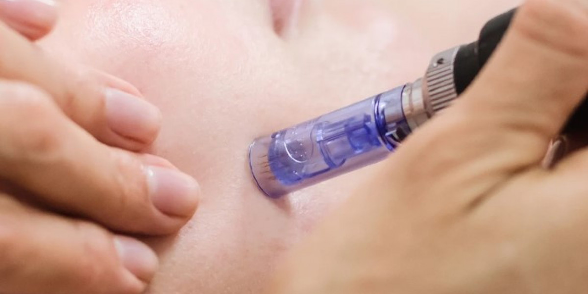 Microneedling in Manchester: Personalized Skin Renewal for Smooth, Healthy Skin